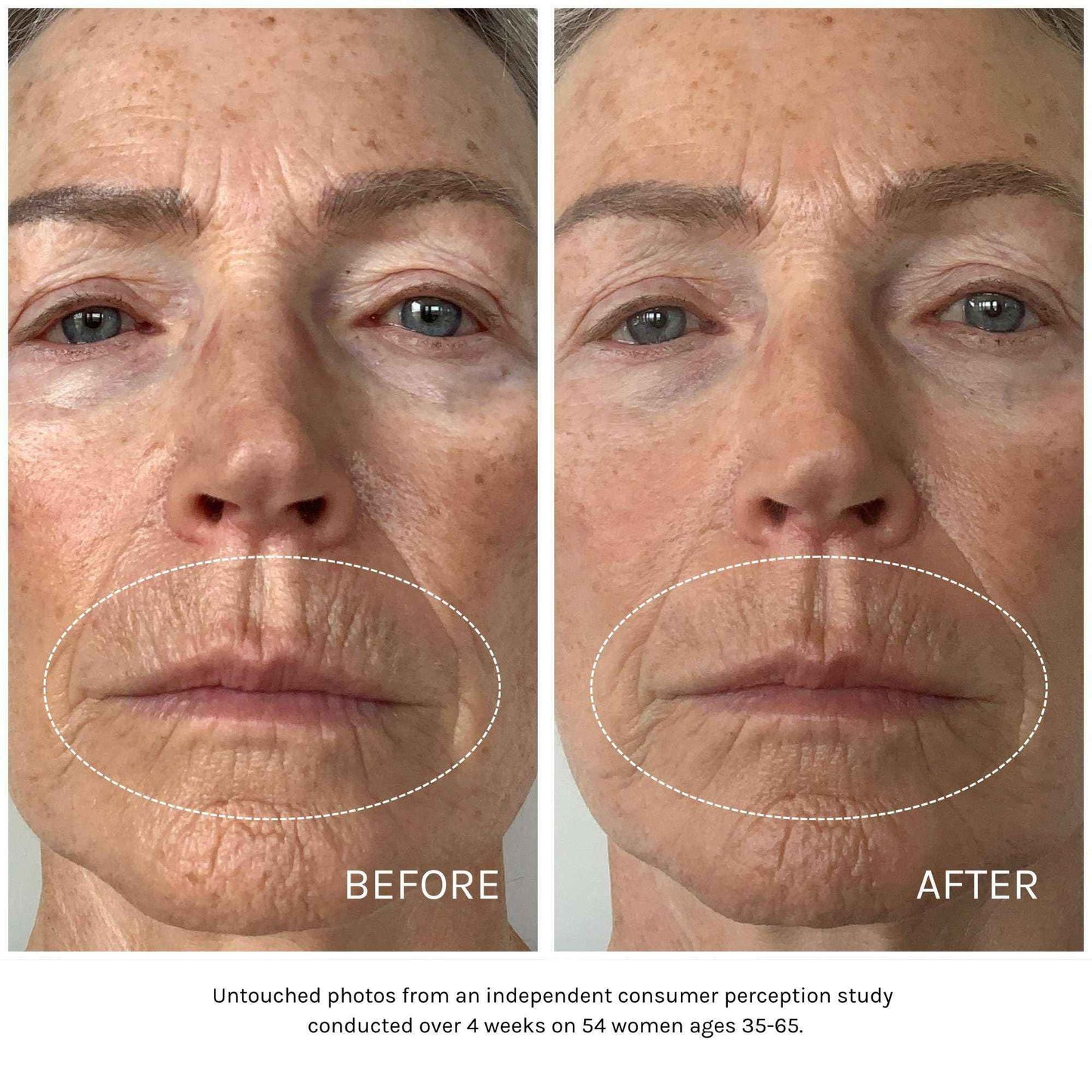 Kari Gran Essential Peptide Serum, Anti-Aging Serum With Matrixyl 3000 OS and 15 Plant Oils (30 ml)