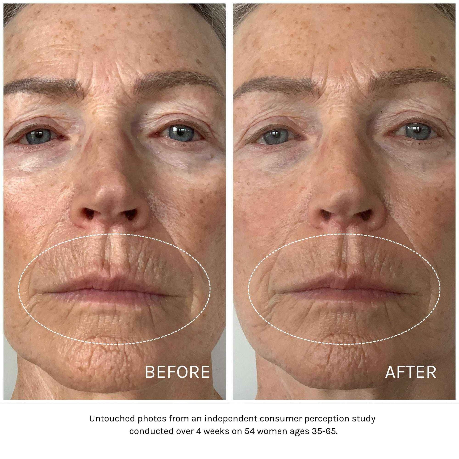 Kari Gran Essential Peptide Serum, Anti-Aging Serum With Matrixyl 3000 OS and 15 Plant Oils (30 ml)