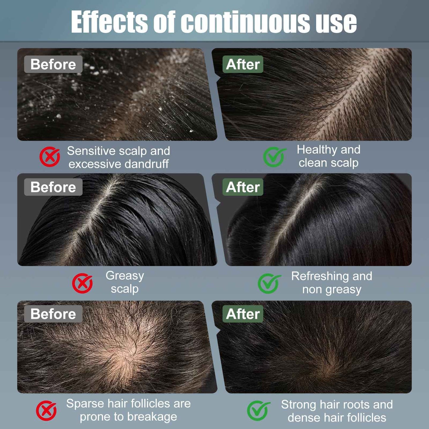 Laser Hair Growth Comb, Red Light Therapy for Hair Growth, Scalp Massager for Thicker