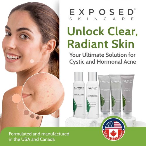 Exposed Skin Care, Expanded Acne Treatment Kit with 2.5% Salicylic Acid and 3.5% Benzoyl Peroxide to Clear Up Teen, Adult, Hormonal and Cystic Acne – Natural, Non-toxic and Cruelty Free