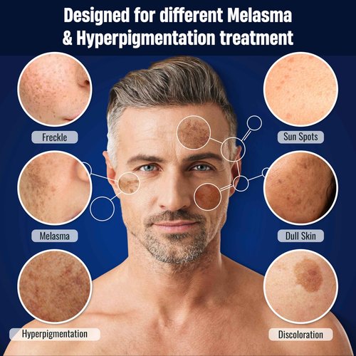 Abera Men Retinol Serum, Reduces Dark Spots, Melasma, Wrinkle & Eye Bag, Hydrating and Smoothing Formula for Men with Niacinamide 5% & Retinyl, Anti-Aging Effect (Set 2 + Gift)