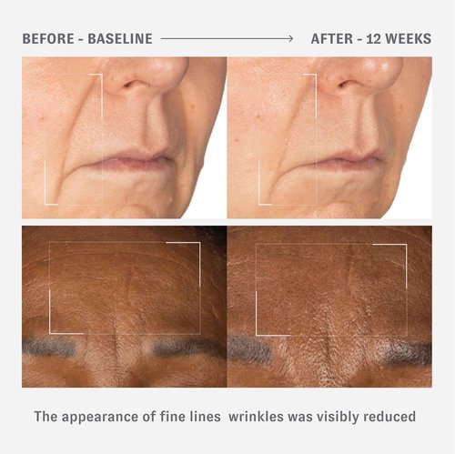 O HUI Reverse Activator Retinol Fine Wrinkle Serum | Korean Skin Care | Comfortable Retinol Serum for Face | Minimal to no irritation | Peptide | Fine Lines & Wrinkles Visibly Reduced by 45%*