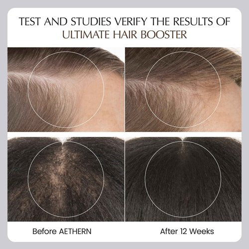 AETHERN Liquid Hair Growth Supplement with Biotin. Ready-to-Drink. Clinically Proven for Stronger and Shinier Hair, Less Shedding, + Scalp Coverage. Anti-Hair Loss. 28 Servings Ultimate Hair Booster