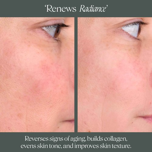 Doctor Rogers Night Repair Treatment REFILL. Restoring & Hydrating Anti-Aging Face Serum with Glycolic Acid, 1 Ounce (30 ml)