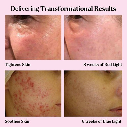 LED Face Mask Light Therapy Premium Spa Kit (4 Pcs) - With Ultrasonic Scrubber, Ultrasonic Brush & Green Tea Serum - 7 Colors (Blue & Red) Light Therapy Mask -Spa Light Therapy Facial For Rejuvenation