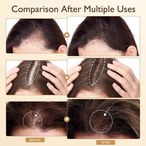Vincofoo PP405 Hair Treatment | SCU-405 | Anti-Hair GLoss Serum | Strengthen Hair Roots | Quickly Absorbed & Non-greasy | PP405 Hair Oil for All Types
