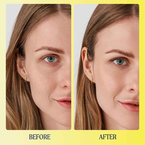 Kinship Supermello Gel Cream Moisturizer + Brightwave Vitamin C Eye Cream Bundle | Lightweight Hyaluronic Acid Face Lotion | Energizing + Brightening Reduce Dark Circles & Puffiness | All Skin Types