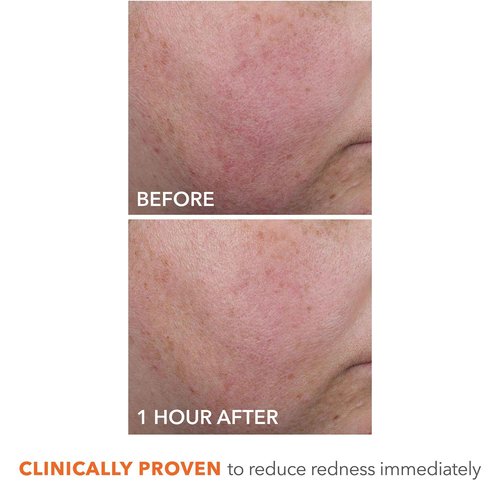 Dr Dennis Gross DermInfusions Blur + Repair Cream, Instantly Blurs Fine Lines, Smooths Skin with Satin-Matte Finish, Visibly Plumps & Firms, Reduces Redness, and Improves Skin Elasticity, 1.7 Fl Oz