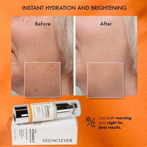 Vegnclever Super Vitamin C Serum - Super Moisturizing, Anti-Aging All-In-One Formula with Niacinamide, Collagen Peptides, Caffeine, and Vitamin E, Original Vitamin C Face Serum - 2 Pack