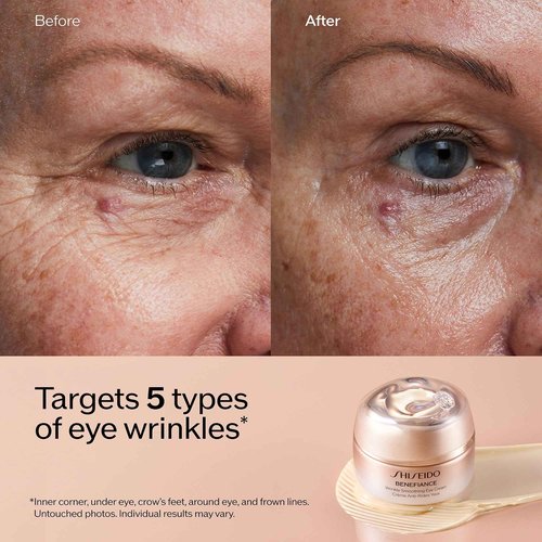 Shiseido Benefiance Wrinkle Smoothing Eye Cream - 15 mL - Visibly Improves Five Types of Eye Wrinkles, Dark Circles & Puffiness - 48-HR Hydration - All Skin Types - Non-Comedogenic