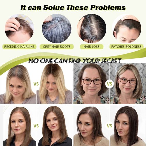 UIPEUBO Hair Toppers for Women Real Human Hair Toppers with Thinning 4.5 * 3 Inch Upgrade Swiss Lace Base Toppers No Bangs for Cover Gray Hair Roots (4T427#)