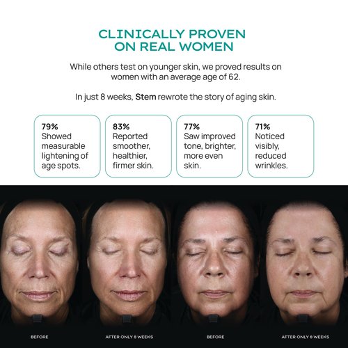 STEM Natural Intelligence ReLuxe Body Serum, Hydrating Serum for Women, Whole Body and Facial Care, Premium Ingredients for Luxury Skin Care, Dermatologist Developed & Tested Research, 5 oz