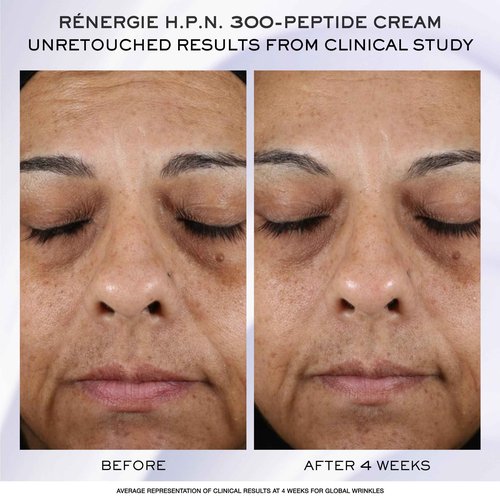 Lancôme Rénergie H.C.F. Triple Serum Discovery Set