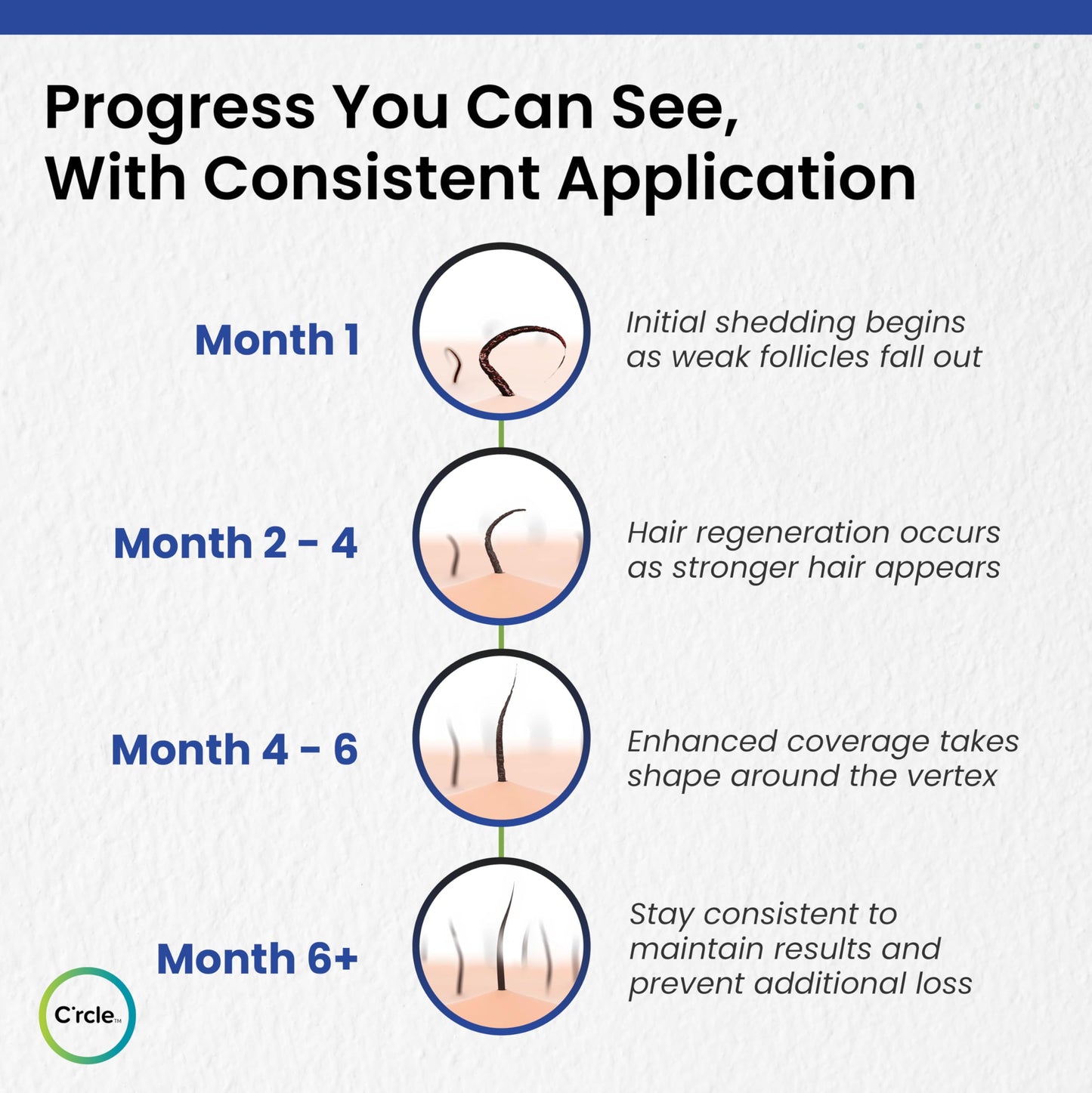 Minoxidil for Men Foam 5% - Unscented 6 Month Supply - Helps Restore Vertex Hair Loss & Thinning - 5% Minoxidil Foam For Men - Extra Strength Supports Hair Regrowth