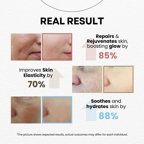 La Noubelle MPC Velvet Glow Serum, All-Day Hydration, Wrinkle Reduction & Revitalizing Skin with Hydrolyzed Collagen, Soybean Peptide and Centella Asiatica Extract, Premium Korean Serum, 1.69 fl oz