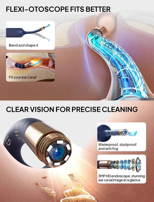 Ear Wax Removal Tool Camera with Light–Visual Ear Cleaner Otoscope Ear Scope, Flexible Wireless Ear Cleaning Kit Ear Picker, Portable Painless Earwax Remover Tweezers for Adults, Kids