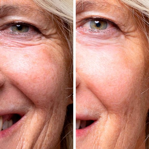 COCUNAT - The Cure - Anti-Ageing Facial Serum - Repairs and Redensifies - Targets Wrinkles, Luminosity and Nourishment - 21 Essential Oils, Antioxidants, Vitamins, Fatty Acids and Bakuchiol - 30 ml