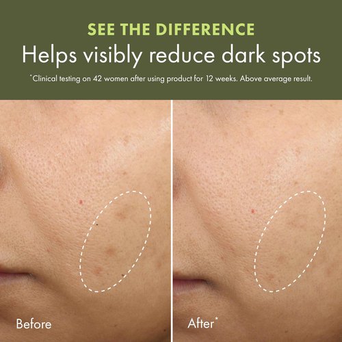 Origins Mega-Mushroom Dark Spot Cream | Reduces Visible Hyperpigmentation & Post-Acne Marks | With Vitamin C & Reishi Mushroom, 1.7 Fl Oz