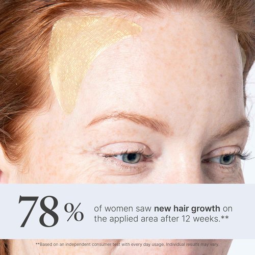 Better Not Younger Superpower™ Thickening Hair Patches for Women 40+ – Hydrogel Hair Regrowth Treatment for Thinning Hairline & Temples. Infused with Capixyl™ & Plant Extracts for Thicker, Fuller Hair