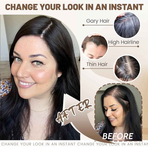 Black and Pretty Human Hair Toppers for Women Real Human Hair Pieces for Women 120% Density Swiss Base Clip In 7 * 10cm Remy Topper 10Inch HairPieces (Dark Brown)