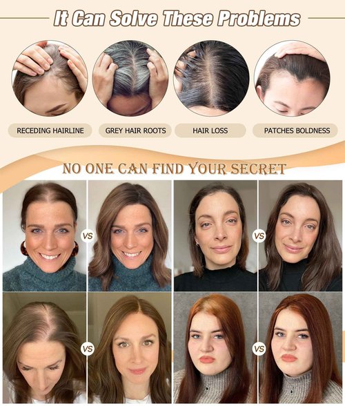 POWERASIA Large Coverage 5.1x5.9inch Hair Toppers for Women Real Human Hair No Bangs Swiss Base Wig Topper Womens Hair Topper for Thinning Hair 150% Density Remy Hair Wiglets #2