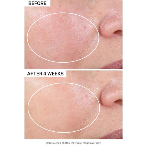StriVectin Advanced Retinol Discovery Kit with Retinol Night Moisturizer, 1 oz, Multi Correct Eye Cream 0.5 oz, 2 Piece Kit for Wrinkles and Fine Lines