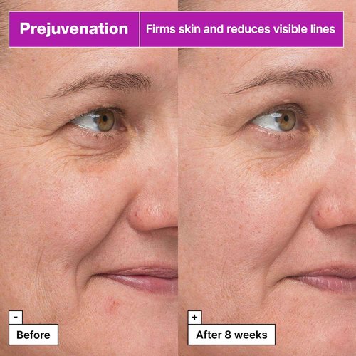 Dr.Jart+ Prejuvenation Firming Bakuchiol Serum for Slow Aging | Korean Anti Aging Serum | Korean Skin Care, 1.69 Fl Oz