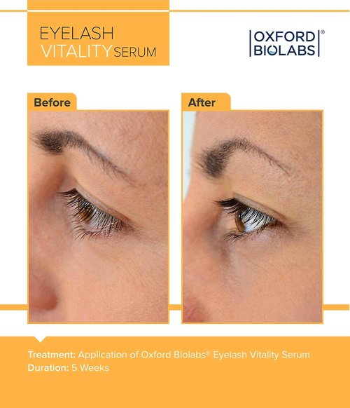 Eyelash Vitality Growth Serum - Lash Enhancing Growth Serum Complex - Irritation Free - Hypoallergenic Naturally-based Turmeric Growth, Achieve Longer Thicker & Healthier Lashes, 3.5 ml