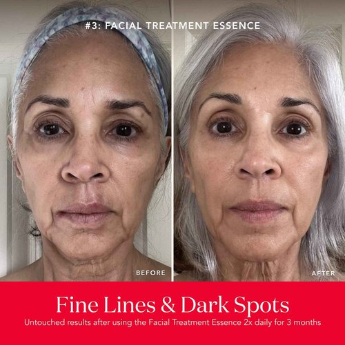 SK-II First Experience Skin Care Set - Gift Set Includes Treatment Face Masks, Facial Essence & Face Toner - Helps Improve Dryness, Refine Skin Texture & Reduce Fine Lines & Wrinkles (4 Count)