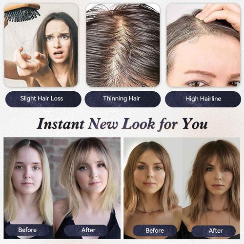 starluck Hair Toppers for Women Real Human Hair with Bangs 4.5"*5.5"Large Base 14 Inch 100% Real Human HairToppers for Women with ThinningHair Cover Gray Roots(ombre Light Blonde)