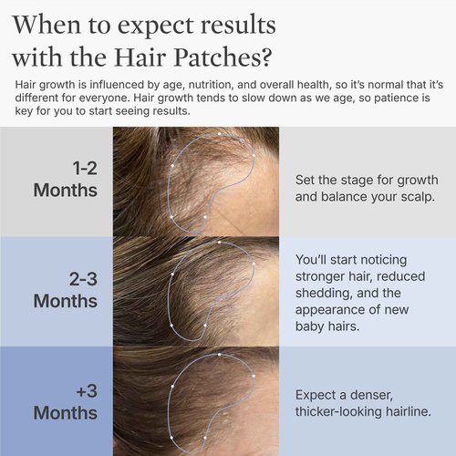 Better Not Younger Superpower™ Thickening Hair Patches for Women 40+ – Hydrogel Hair Regrowth Treatment for Thinning Hairline & Temples. Infused with Capixyl™ & Plant Extracts for Thicker, Fuller Hair