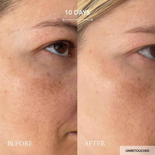 KAT BURKI 15% Stabilized Vitamin C Intensive Face Cream, Radiance-Boosting Moisturizer for Glowing, Hydrated Skin, 1 Fl Oz