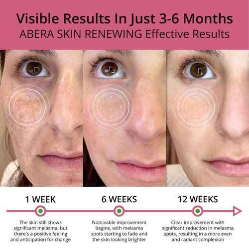 Combo Abera Saffron Serum For Melasma Treatment & Abera Dark Lip Corrector Cream, Lip Balm For Lightening & Brightening Dark Lip For Men & Woman