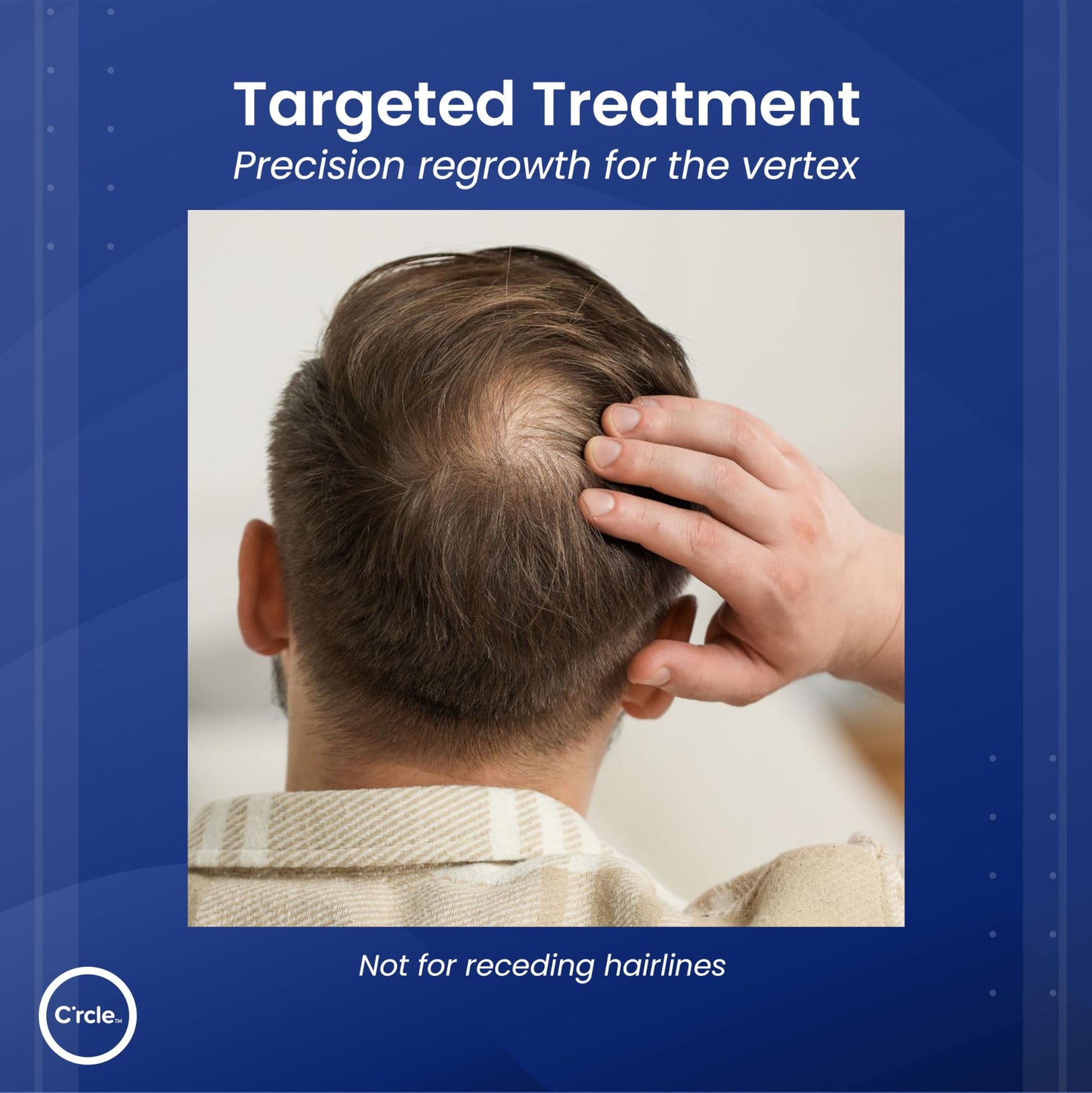 Minoxidil for Men Foam 5% - Unscented 6 Month Supply - Helps Restore Vertex Hair Loss & Thinning - 5% Minoxidil Foam For Men - Extra Strength Supports Hair Regrowth