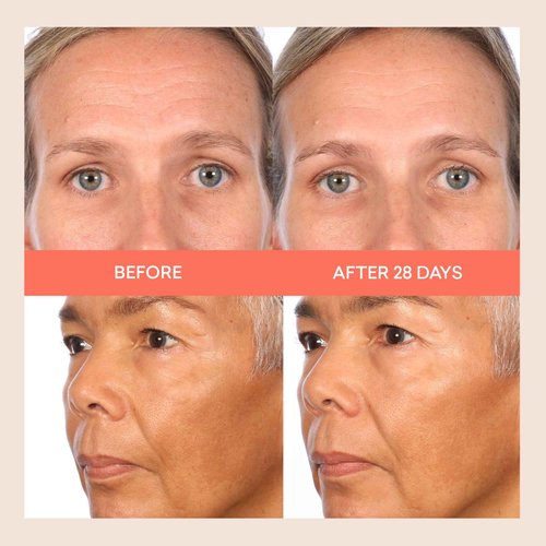 toty. by Sofia Vergara - Transforma AHA 360º Retexturizing Serum - Sun Damage Repair For Face - Glycolic Acid Serum - Anti Aging Treatment for Dark Spots, Lines, Wrinkles - Travel Size (0.5 fl oz)