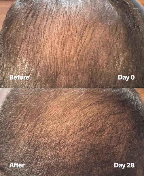 SickScience PowerCycle Exosome Hair Growth Serum - Clinically Advanced Scalp Treatment for Thinning Hair, Hair Loss Prevention & Regrowth - Lightweight Formula for Women & Men, Without Minoxidil, 60mL