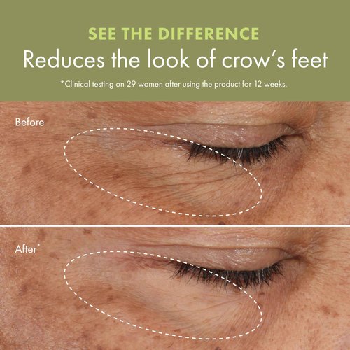 Origins Plantscription Wrinkle Correction Retinol Eye Cream | Visibly Reduces Crow's Feet | With Encapsulated Retinol, 0.5 Fl Oz