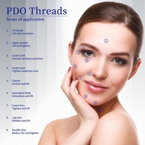 SOZOOM PDO Screw Threads, PDO Thread Lift KOREA Pdo Threads Whole Body Lifting (100PCS-29G-38mm)