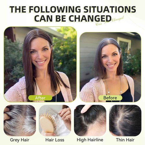 RSY Medium Brown Hair Toppers for Women with Thinning Hair, 100% Real Human Hair Pieces for Women, 5"*5" Mono Top 14 Inch Clip in Extensions with No Bangs