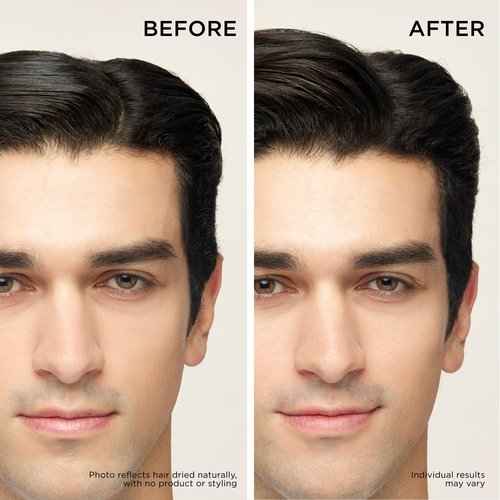 Dr. Groot Thickening Shampoo & Scalp Treatment Set for Hair Loss – Clinical Results with Biotin and Rosemary for Hair Thinning, Shedding, Scalp Repair and Treatment