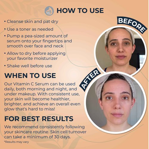 Foxbrim Naturals Radiant Eye & Face Duo: Probiotic Eye Cream & Vitamin C Face Serum