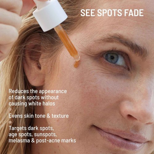 Dr. Brandt Bright This Way Dark Spots No More - Reduces Number, Intensity & Size of Pigmented Spots - 0.5 fl oz