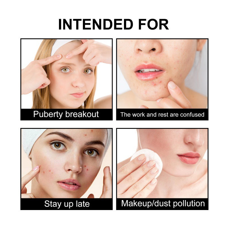 Black Acne Cover Patches 108pcs - Spot Treatment for Clear Skin