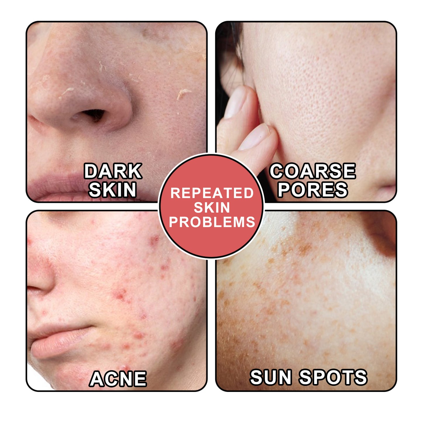 Nicotinamide Facial Essence Serum - Hydrating and Brightening Skin Care