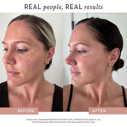 Vitamin C Serum for Face – All-in-One Formula – Profesional Grade AAP & THD, Peptides, 3X Hyaluronic Acid – For Sensitive Skin – Brightens, Firms & Hydrates – 1 oz