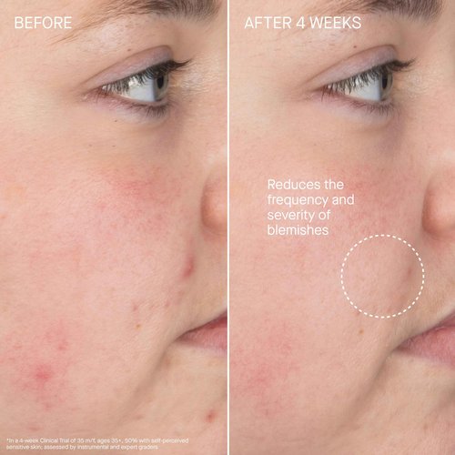 Augustinus Bader The Foaming Cleanser – Luxury Gentle Hydrating Face Cleanser – Removes Impurities & Excess Oil While Supporting Skin Barrier – Soothing & Non-Drying Formula – 150 ml / 5 fl oz