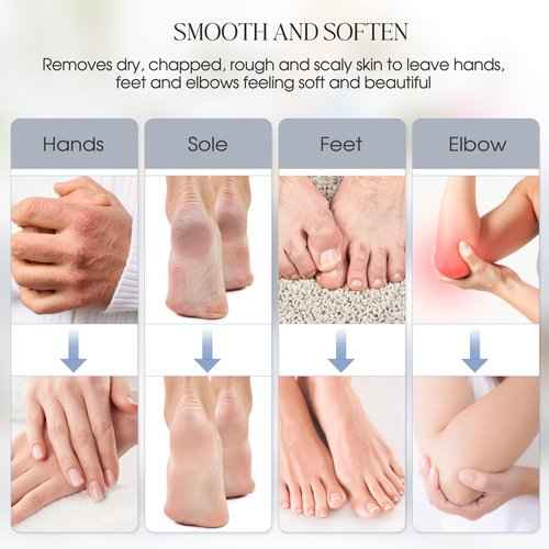 Achzzy Paraffin Wax Machine for Hands and Feet, 4000ml Paraffin Bath, Paraffin Wax Warmer with Refills, Fast Wax Meltdown, Precision Temperature Control