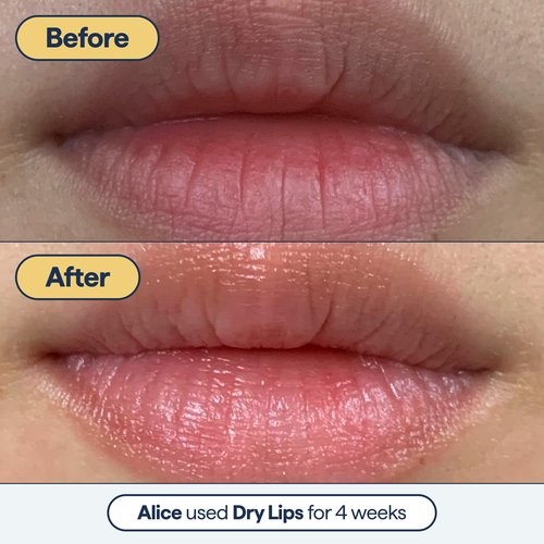 Dr. Shah's Dermatologist Bundle: 2x Remedy for Pore Size with Retinol, BHA Salicylic Acid & Niacinamide for Large Pores + 1x Remedy for Dry Lips with Ceramides, Peptides & Dimethicone for Cracked Lips