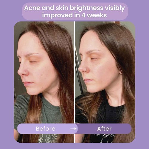 Bohemia Skin Infinite Aura Face Moisturizer – Facial Lotion for Women; Hyaluronic Acid + Ceramide Wrinkle Barrier Repair Cream, Beta-Glucan Redness Relief, Copper Peptide Firming Anti Aging Day-Night