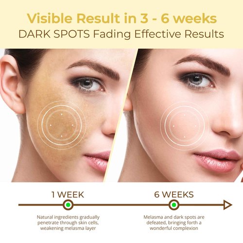 ABERA Kasumi Face Cream, Hydrating Treatment for Face, Smooth Enhancer, Extensive Moisturizer (0.7 Oz Per Item) (2 Box)